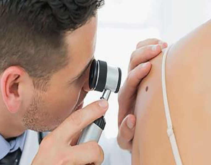 photo of a doctor looking at a patient's mole on her shoulder